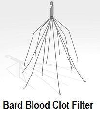 Bard Recovery Blood Clot Filter Flawed