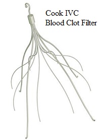 Cook Blood Clot Filter Lawsuits